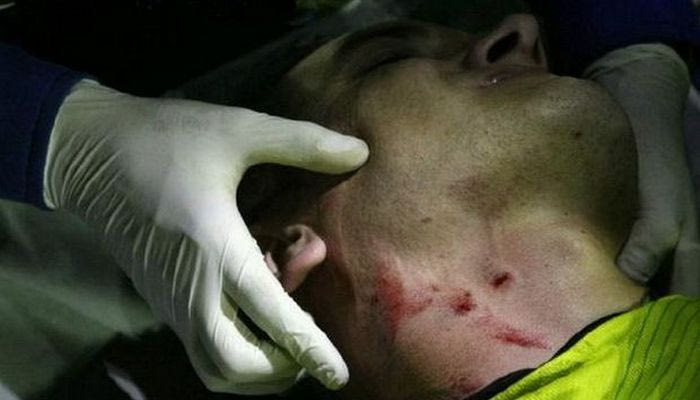 Τον πάτησε στον λαιμό με τις τάπες (VIDEO)