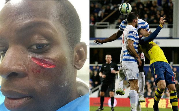 ΑΝΑΤΡΙΧΙΛΑ: Το πρόσωπο του Ονουόχα μετά από σύγκρουση (PHOTO)