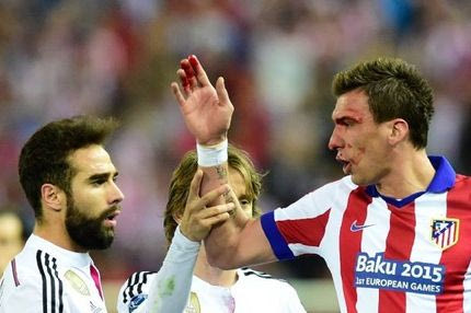 Σημάδι από δάγκωμα στο χέρι του Μάντζουκιτς (PHOTO)