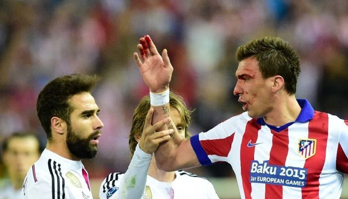 Σημάδι από δάγκωμα στο χέρι του Μάντζουκιτς (PHOTO)