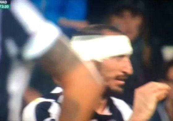 Κιελίνι σε Ρονάλντο: “Πολύ μιλάς…” (VIDEO)