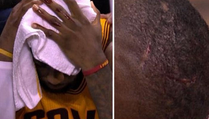 O Λεμπρόν έπεσε με το κεφάλι πάνω στην κάμερα