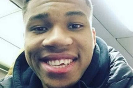 Έσπασε το δόντι του ο Αντετοκούνμπο!