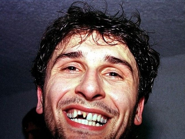 Όταν ο Μπάνε έπαιζε με… σπασμένα δόντια