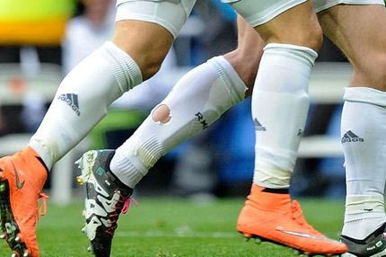 Γι’ αυτό φορά τρύπιες κάλτσες ο Μπέιλ