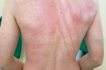 Άγριο ξύλο σε παίκτριες στην Ισπανία