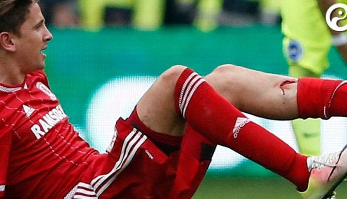 Ο σοκαριστικός τραυματισμός του Ραμίρες