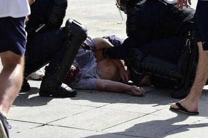 Σε κρίσιμη κατάσταση Άγγλος οπαδός