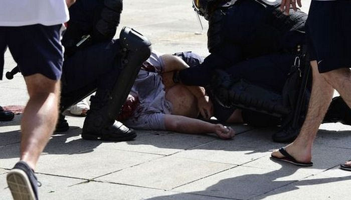 Σε κρίσιμη κατάσταση Άγγλος οπαδός