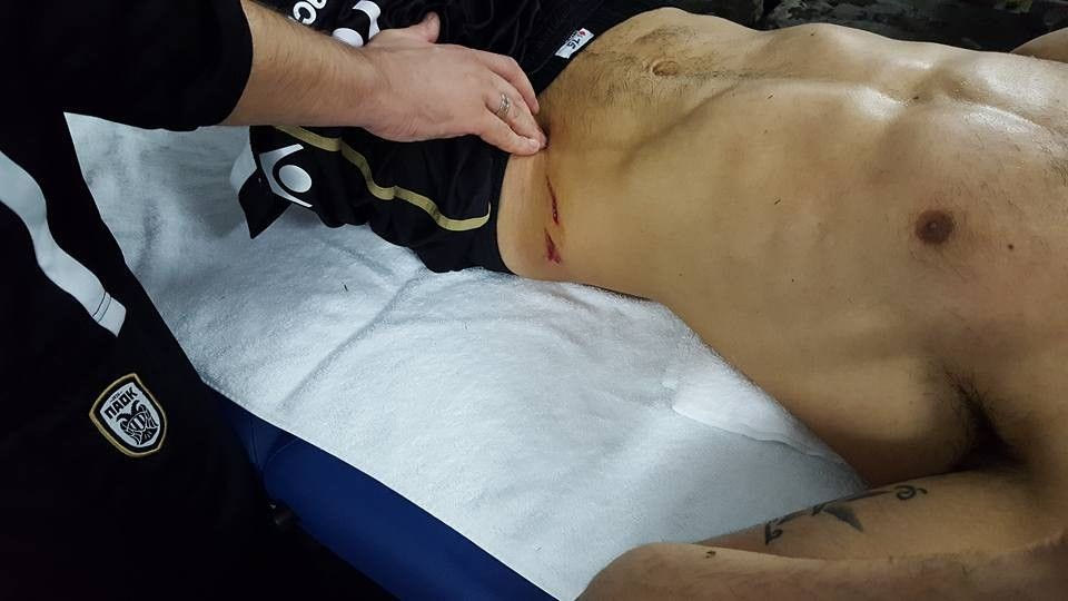 Το τραύμα του Κρέσπο από το μαρκάρισμα του Μπέρτου