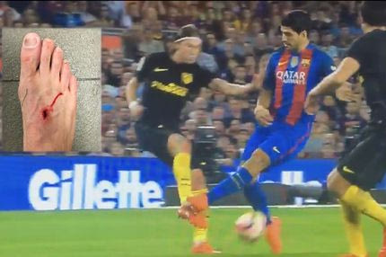 Σουάρες σε Φελίπε Λουίς: “Το ποδόσφαιρο είναι για άντρες”!