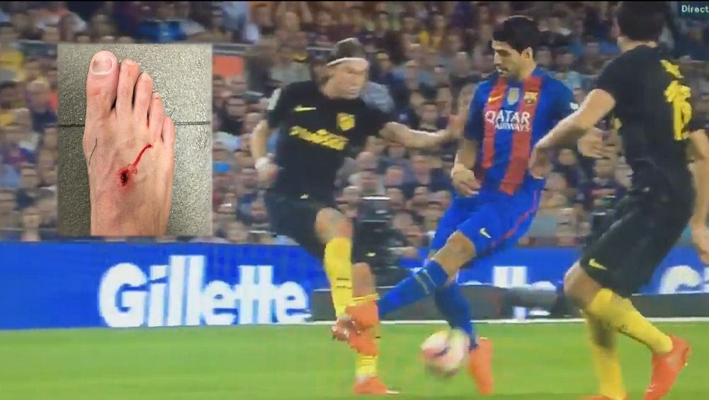 Σουάρες σε Φελίπε Λουίς: “Το ποδόσφαιρο είναι για άντρες”!