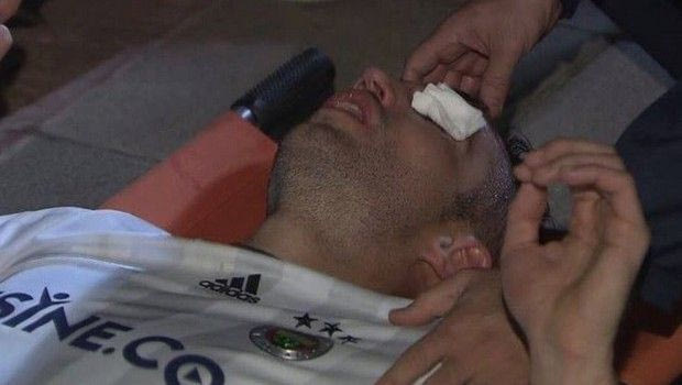 Τρομακτικός τραυματισμός του Φαν Πέρσι στο μάτι