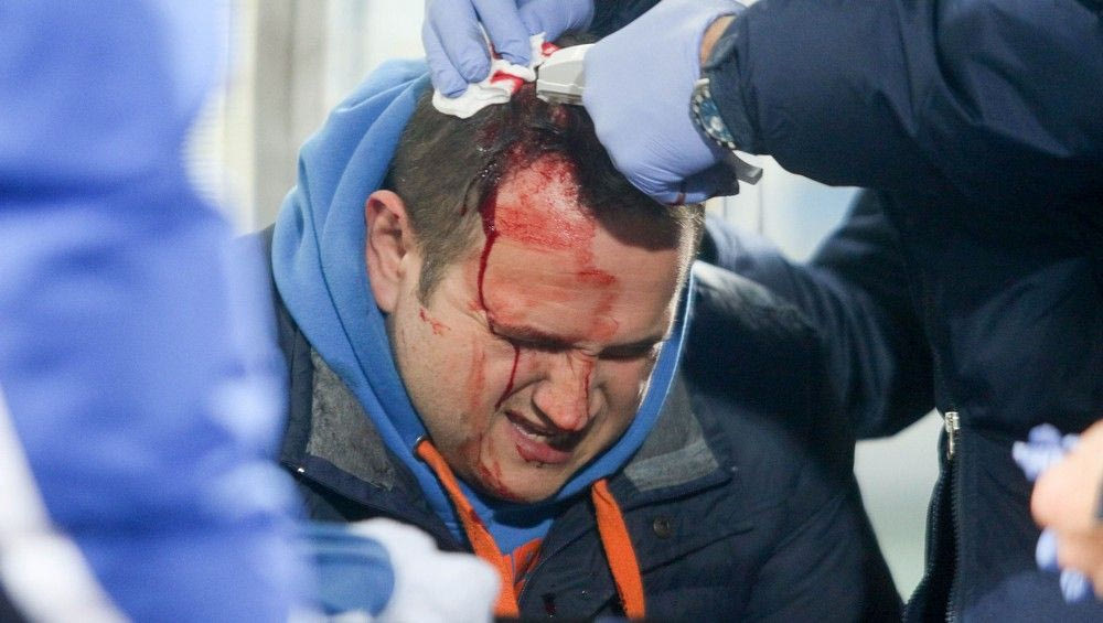 Επεισόδια και τραυματισμός δημοσιογράφου στο Ηρακλής-ΠΑΣ