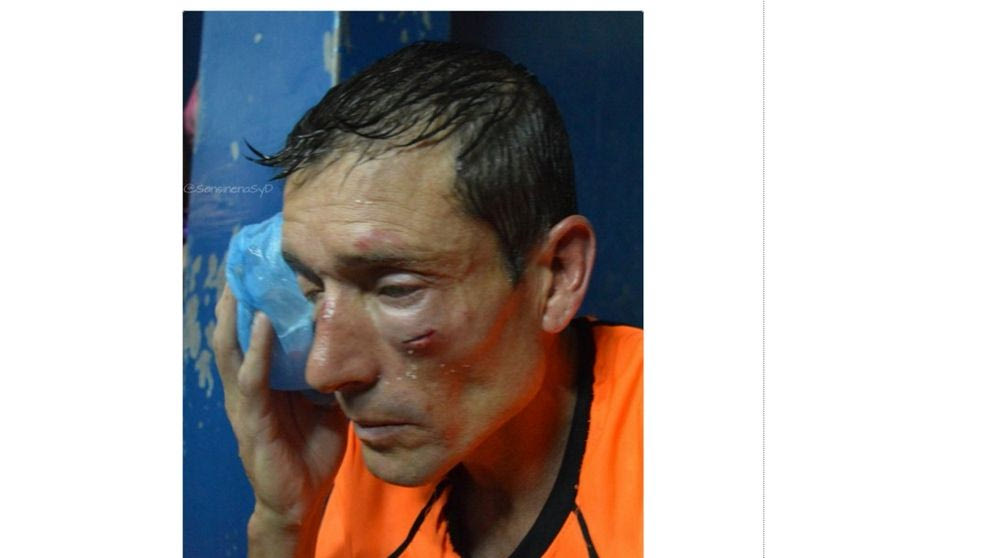 Διαιτητής έφαγε το ξύλο της αρκούδας στην Αργεντινή