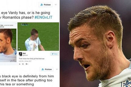 Γλέντι στο Twitter με το μαυρισμένο μάτι του Βάρντι!