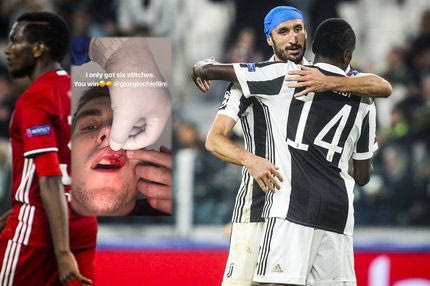 Τα… παράσημα του Ένγκελς από το χτύπημα με τον Κιελίνι