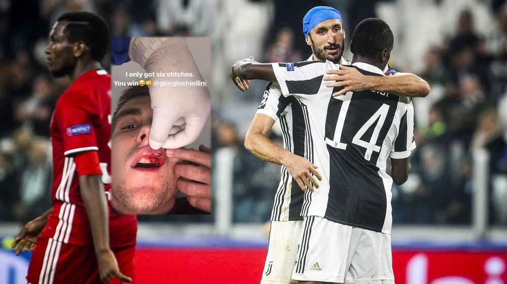 Τα… παράσημα του Ένγκελς από το χτύπημα με τον Κιελίνι