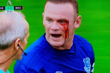 O ματωμένος Ρούνεϊ τρέλανε τα social media!