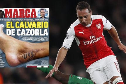 Σοκάρει το οκτώ φορές εγχειρισμένο πόδι του Καθόρλα