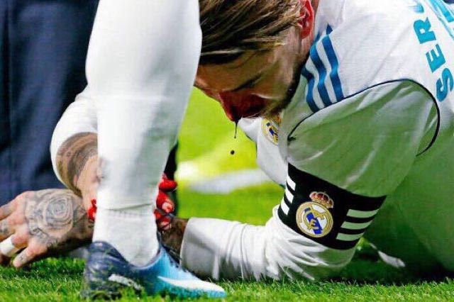 Ματωμένος Ράμος: Η φωτογραφία και το μήνυμα του αρχηγού της Ρεάλ που συγκλονίζει