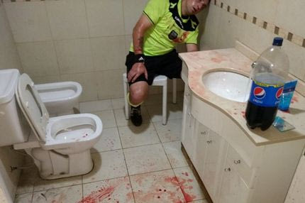 Εικόνες σοκ: Άνοιξαν το κεφάλι διαιτητή στην Αργεντινή!