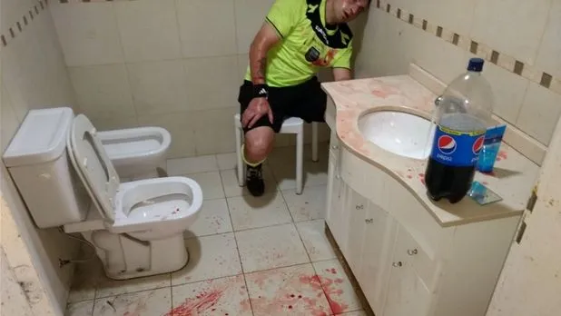 Εικόνες σοκ: Άνοιξαν το κεφάλι διαιτητή στην Αργεντινή!