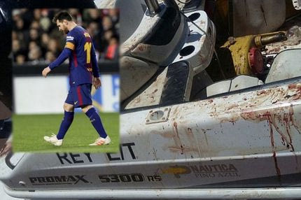 Καταζητείται ο αδερφός του Μέσι για ένα ματωμένο… όπλο!