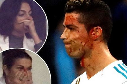 Ο τραυματισμός του Ρονάλντο σόκαρε τις δύο γυναίκες της ζωής του!