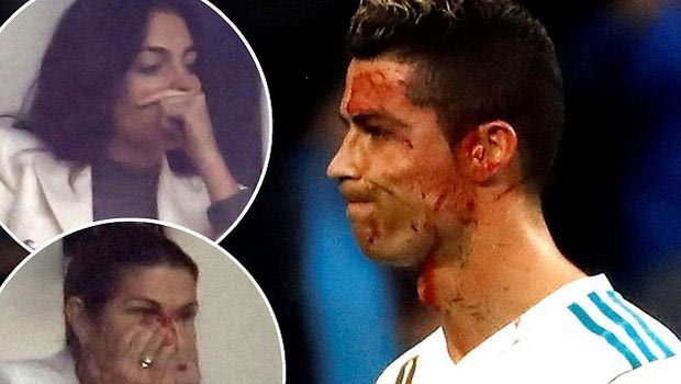 Ο τραυματισμός του Ρονάλντο σόκαρε τις δύο γυναίκες της ζωής του!