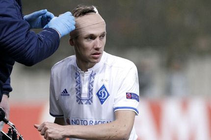 Ο Χαρμάς έψαξε την κόκκινη και… δεν την πήρε ΠΟΤΕ