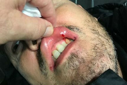 Το… μάπετ σόου στην εκδίκαση!