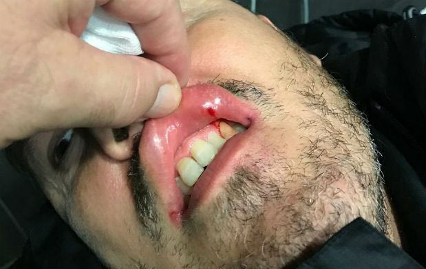 Το… μάπετ σόου στην εκδίκαση!