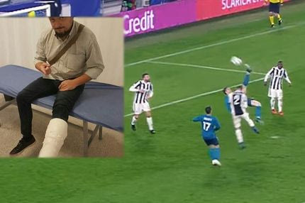 Πήγε να κάνει το ψαλιδάκι του Κριστιάνο και έσπασε το πόδι του!