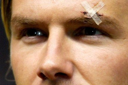 “Όταν ο Φέργκιουσον μου επιτέθηκε με ένα παπούτσι”: Μια αφήγηση από τον Ντέιβιντ Μπέκαμ