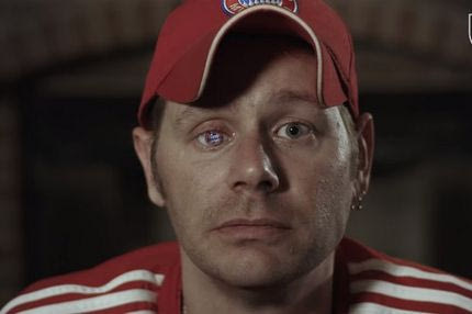 Ο πιο φανατικός φίλος της Μπάγερν έχει… μάτι Μπάγερν