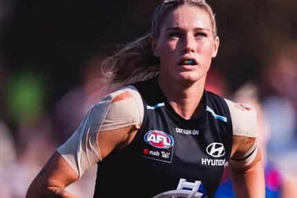 Η φωτογραφία της Τέιλα Χάρις που προκάλεσε απερίγραπτο πόλεμο σεξισμού