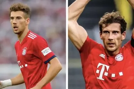 Η μεταμόρφωση στο σώμα του Γκορέτσκα είναι εξωπραγματική